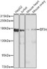Immunology Antibodies 1 Anti-EIF3A Antibody CAB0573
