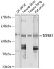 Cell Biology Antibodies 1 Anti-TGFBR3 Antibody CAB0627