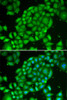 Cell Biology Antibodies 1 Anti-TCL1A Antibody CAB0629