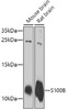 Cell Biology Antibodies 1 Anti-S100B Antibody CAB0676