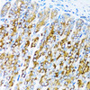 Cell Death Antibodies 1 Anti-ACVR1C Antibody CAB0678