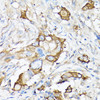 Cell Biology Antibodies 1 Anti-MMP7 Antibody CAB0695