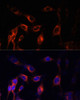 Cell Biology Antibodies 1 Anti-TSC1 Antibody CAB0720