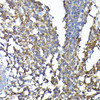 KO Validated Antibodies 1 Anti-CSK Antibody CAB0735KO Validated