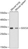 Developmental Biology Anti-SOCS3 Antibody CAB0769
