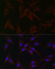 Cell Death Antibodies 1 Anti-cIAP2 Antibody CAB0833