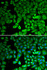 Epigenetics and Nuclear Signaling Antibodies 1 Anti-NUR77 Antibody CAB0843