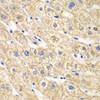 Metabolism Antibodies 1 Anti-ACADS Antibody CAB0945