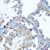 Immunology Antibodies 1 Anti-Hsp60 Antibody CAB0969