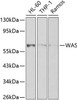 Cell Biology Antibodies 1 Anti-WAS Antibody CAB0978