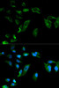 Cell Biology Antibodies 1 Anti-NEK8 Antibody CAB0984