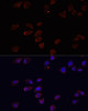 Cell Cycle Antibodies 1 Anti-ARF6 Antibody CAB0988