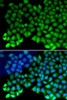 Epigenetics and Nuclear Signaling Antibodies 1 Anti-RPA1 Antibody CAB0990