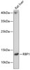 Signal Transduction Antibodies 1 Anti-RBP1 Antibody CAB10029