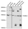 Cell Biology Antibodies 1 Anti-ROBO2 Antibody CAB10070