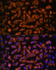 Immunology Antibodies 1 Anti-DAG1 Antibody CAB10076