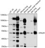 Immunology Antibodies 1 Anti-IFNLR1 Antibody CAB10082