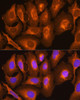 Immunology Antibodies 1 Anti-HLA-C Antibody CAB1013