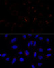 Cell Biology Antibodies 1 Anti-ETHE1 Antibody CAB10142