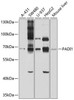 Cell Biology Antibodies 1 Anti-PADI1 Antibody CAB10145