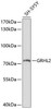 Epigenetics and Nuclear Signaling Antibodies 1 Anti-GRHL2 Antibody CAB10153