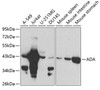 Cell Biology Antibodies 1 Anti-ADA Antibody CAB1019