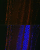 Cell Biology Antibodies 1 Anti-LOXL1 Antibody CAB10191