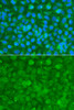 Immunology Antibodies 1 Anti-SERPINA3 Antibody CAB1021