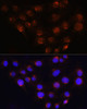 Cell Biology Antibodies 1 Anti-GOLGA4 Antibody CAB10216