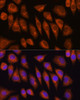 Cell Biology Antibodies 1 Anti-GOLGA4 Antibody CAB10216