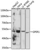 Cell Death Antibodies 1 Anti-GPER1 Antibody CAB10217