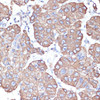 Cell Cycle Antibodies 1 Anti-Cytokeratin-18 Antibody CAB1022