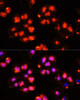 Epigenetics and Nuclear Signaling Antibodies 1 Anti-HOXB9 Antibody CAB10222