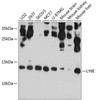 Cell Biology Antibodies 1 Anti-LY6E Antibody CAB10225