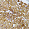 Cell Cycle Antibodies 1 Anti-SEPT4 Antibody CAB10238