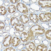 Cell Biology Antibodies 1 Anti-RPS15A Antibody CAB10241