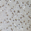 Cell Cycle Antibodies 1 Anti-Cyclin K Antibody CAB10261