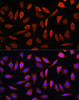 Signal Transduction Antibodies 1 Anti-ZIP8 Antibody CAB10395