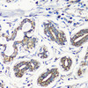 Cell Biology Antibodies 1 Anti-MMP16 Antibody CAB10409