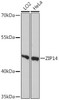 Signal Transduction Antibodies 1 Anti-ZIP14 Antibody CAB10413
