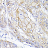 Developmental Biology Anti-SEMA4F Antibody CAB10432