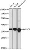 Metabolism Antibodies 1 Anti-AKR1C2 Antibody CAB1048