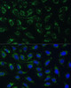 Metabolism Antibodies 1 Anti-AKR1C2 Antibody CAB1048