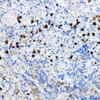 Cell Biology Antibodies 1 Anti-TREM2 Antibody CAB10482