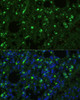 Cell Biology Antibodies 1 Anti-TREM2 Antibody CAB10482