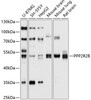 Cell Death Antibodies 1 Anti-PPP2R2B Antibody CAB10494