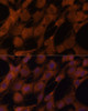 Cell Biology Antibodies 2 Anti-LGMN Antibody CAB10570