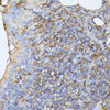 Cell Death Antibodies 1 Anti-STK24 Antibody CAB10576