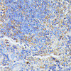 Cell Death Antibodies 1 Anti-STK24 Antibody CAB10576