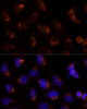 Epigenetics and Nuclear Signaling Antibodies 1 Anti-SEC14L2 Antibody CAB10586